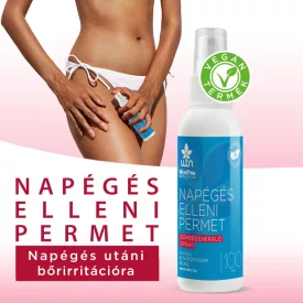 WTN Napégés elleni permet 100ml bőrregeneráló spray