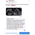 Pcos teakeverék 80 g